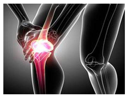 类风湿性关节炎有什么症状呢?